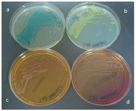 p aeruginosa on macconkey agar|MacConkey Medium .